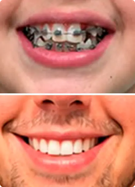 Resultado de ortodontia