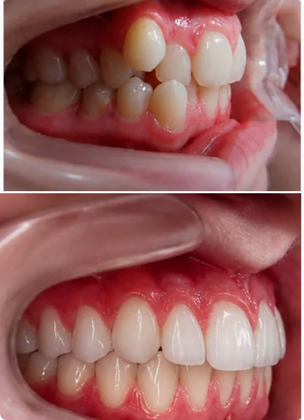 Resultado de ortodontia